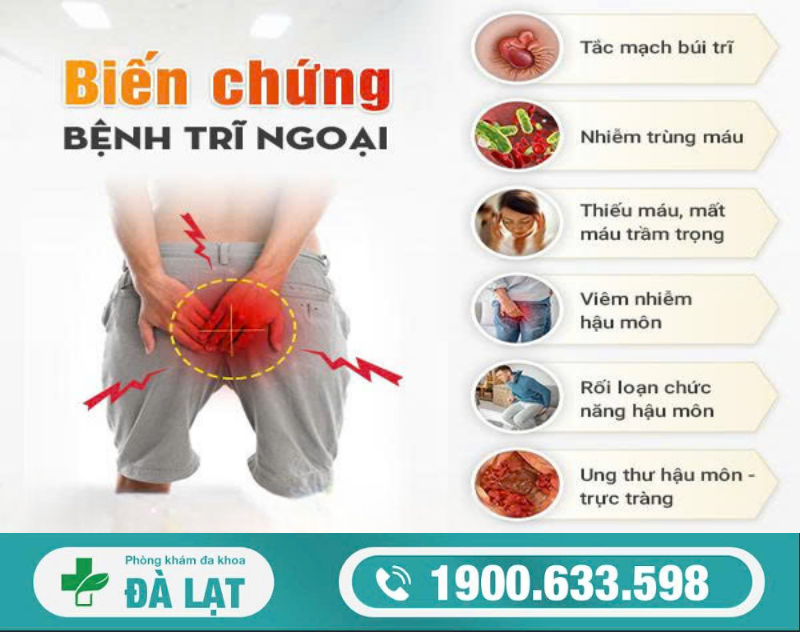 Hình ảnh minh họa